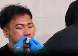 COD Berujung Penusukan, Penjual Handphone Diserang Pembeli di Mojokerto