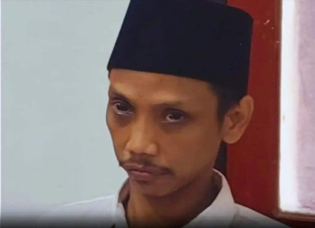 Nyaris Tewas Dibacok Parang 60 Cm, Tukang Cukur Kini Hidup dengan Cacat Permanen