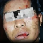 Residivis Curanmor Dilumpuhkan Polisi Usai Kejar-kejaran dari Gumukmas hingga Sumberbaru