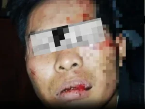 Residivis Curanmor Dilumpuhkan Polisi Usai Kejar-kejaran dari Gumukmas hingga Sumberbaru