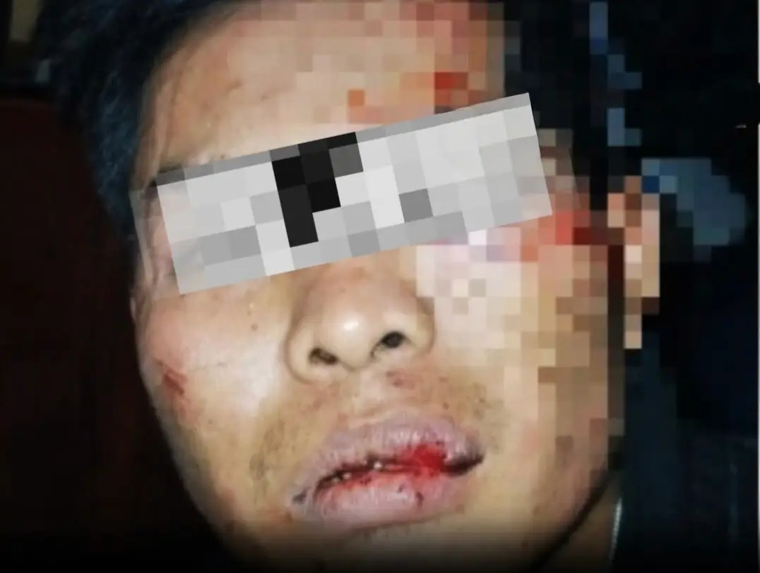 Residivis Curanmor Dilumpuhkan Polisi Usai Kejar-kejaran dari Gumukmas hingga Sumberbaru