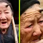 Perempuan 101 Tahun Miliki Tanduk Hitam di Dahi, Tumbuh Hampir 6 Sentimeter