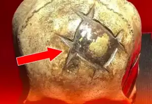 Misteri Tengkorak Emas Nazca, Bukti Bedah Kuno Yang Mengangumkan